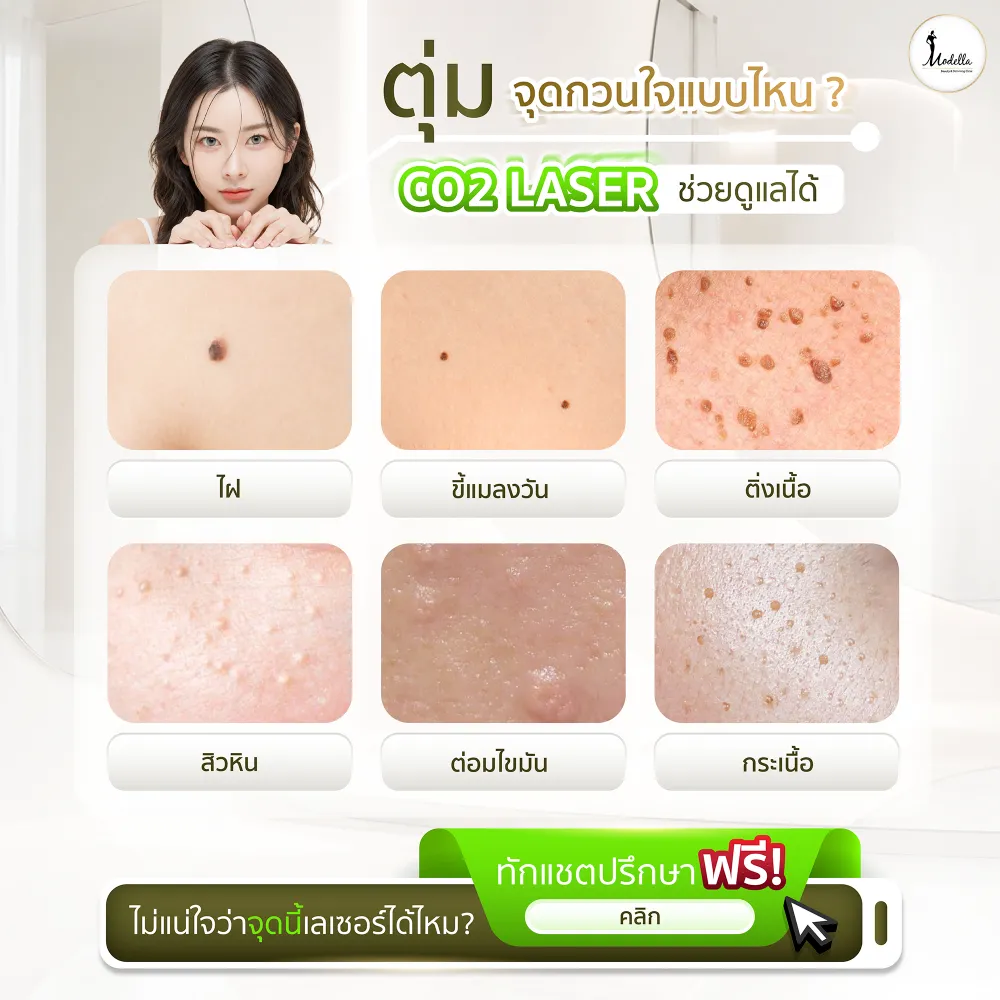 CO2 Laser ช่วยดูแลปัญหาผิวอะไรได้บ้าง 